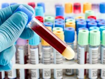 Guida agli esami del sangue