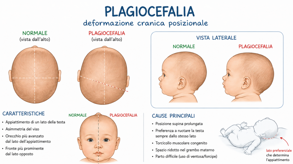 Craniometria cranica nel neonato: la valutazione precoce che può fare la differenza